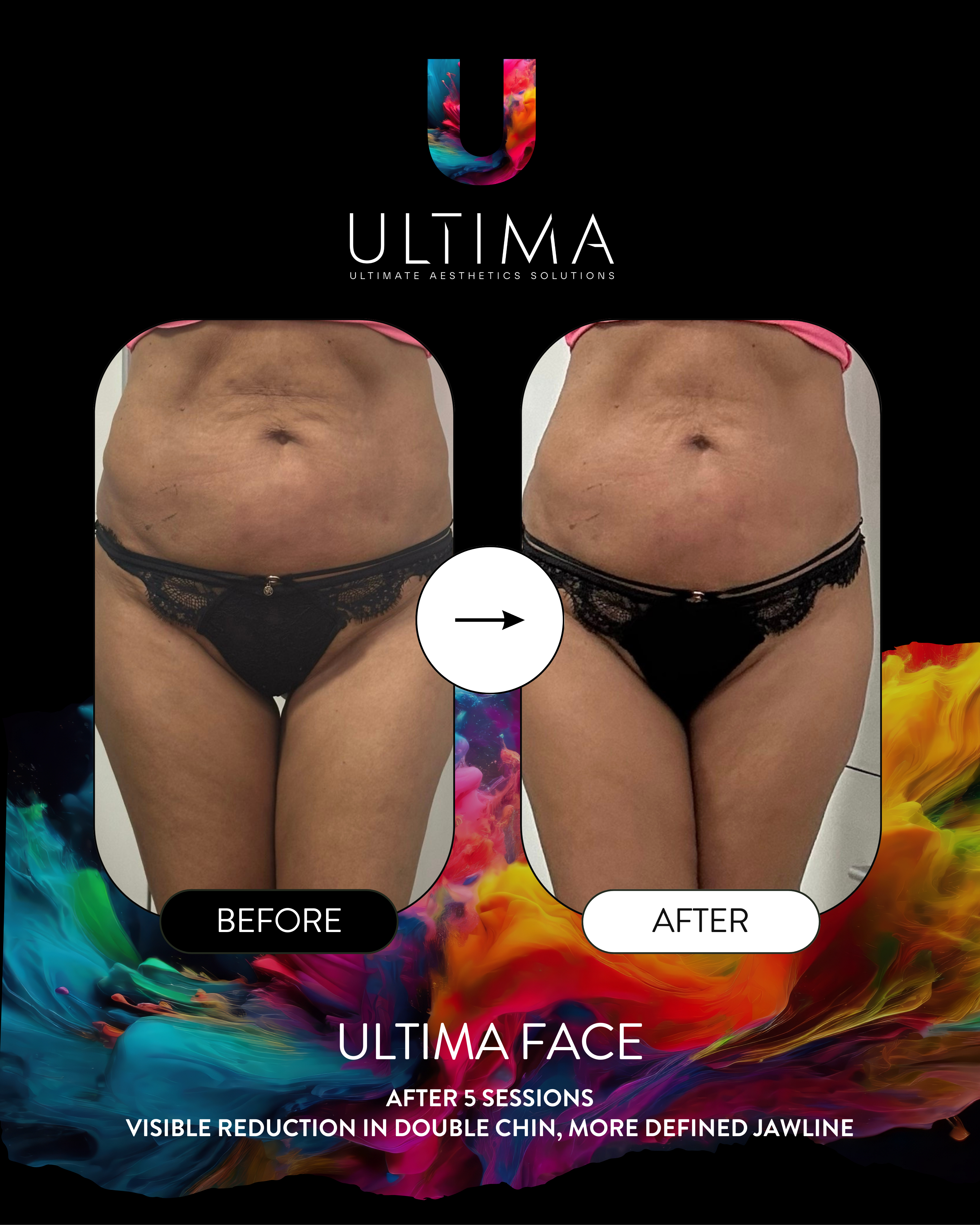 Hasfal ULTIMA eredmény