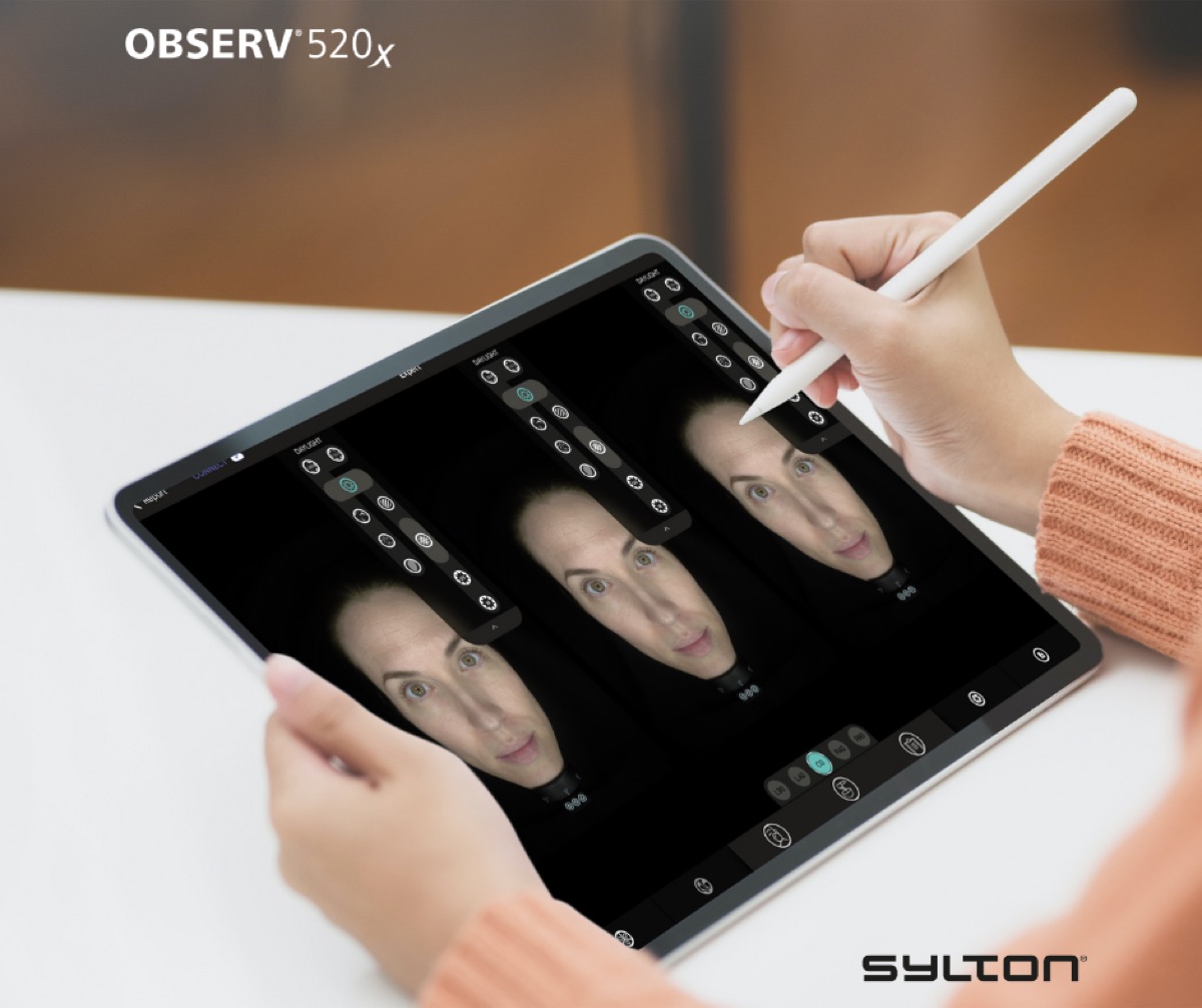 7/14 — Observ 520x bőrelemzés módok