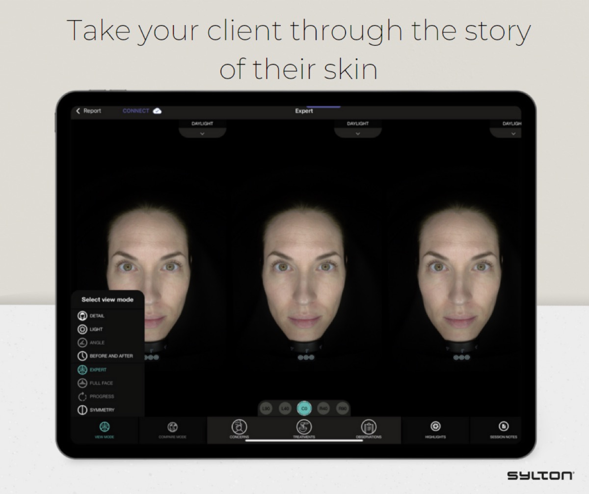 8/14 — UV károsodás feltérképezése