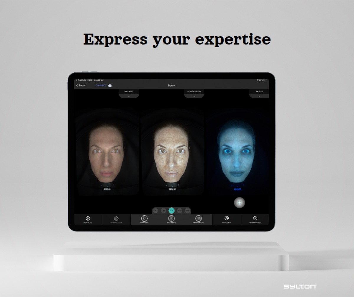 11/14 — Pórusméret vizsgálat