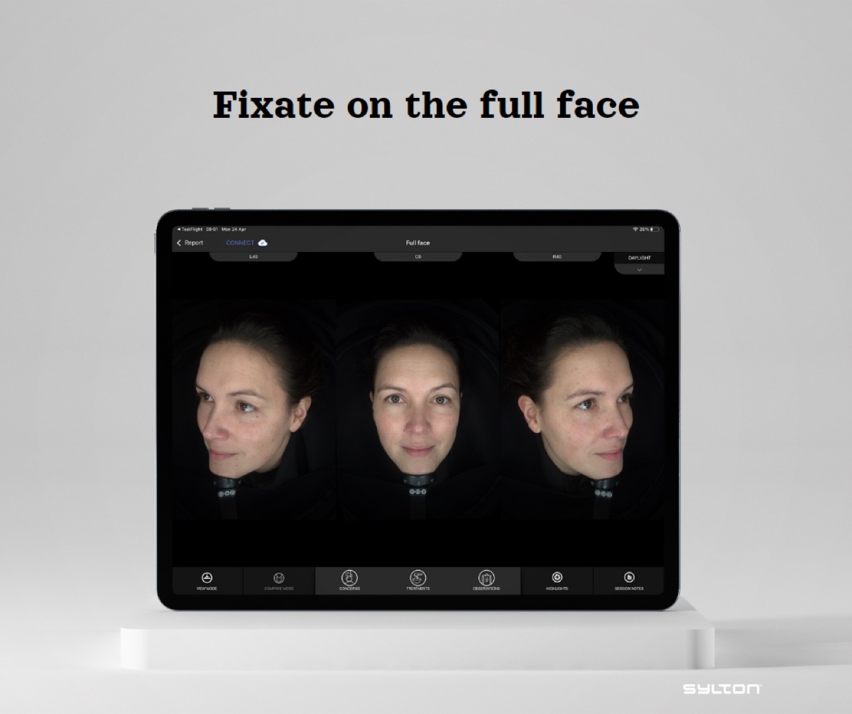 14/14 — Observ 520x prémium bőrdiagnosztika